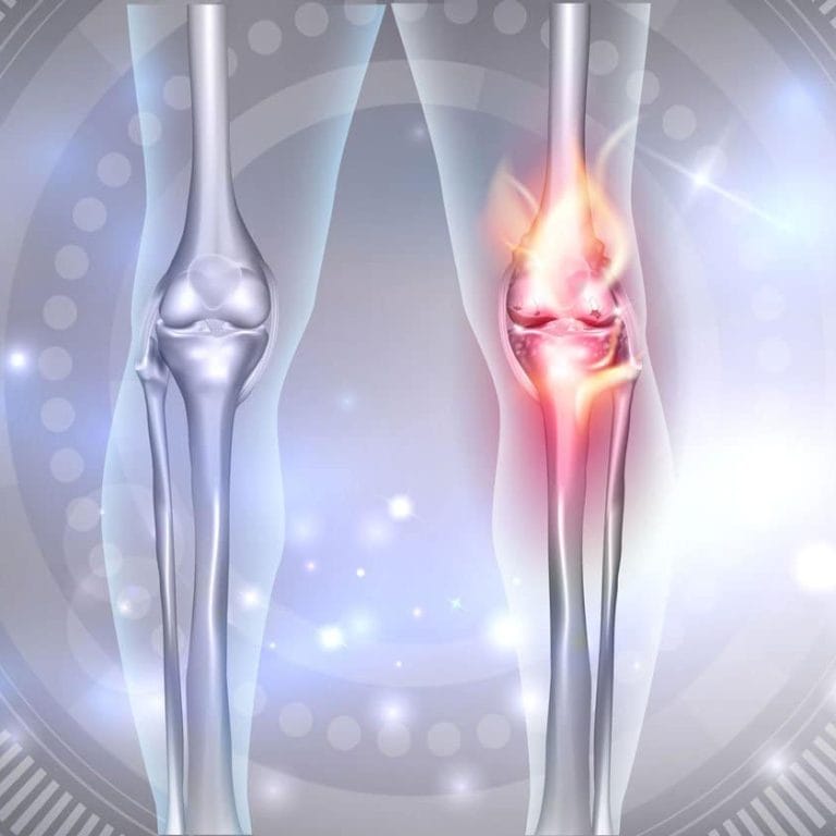 Joint Knie 1500